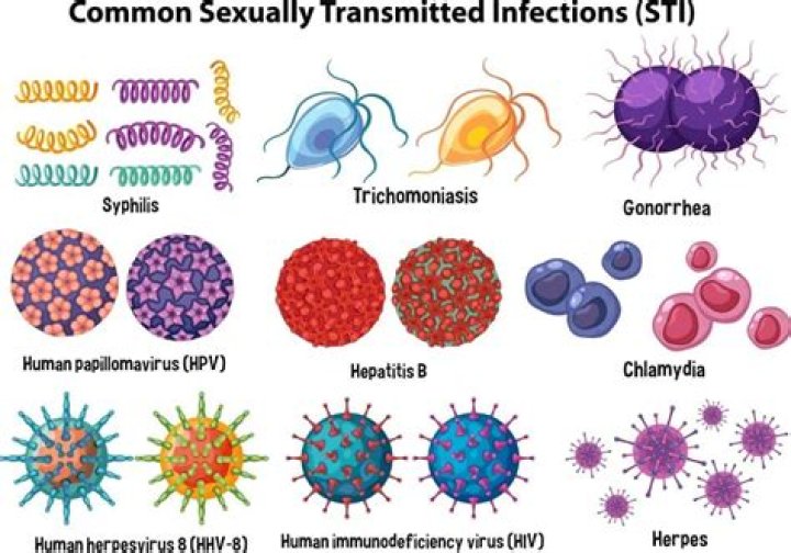 Are all STDs viruses?