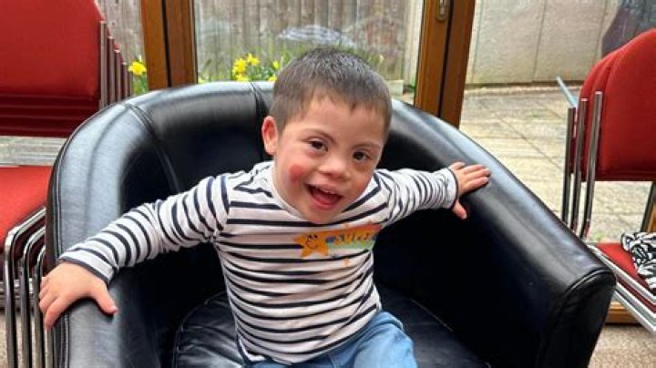 Are George Clooney's Twins Affected By Down Syndrome?