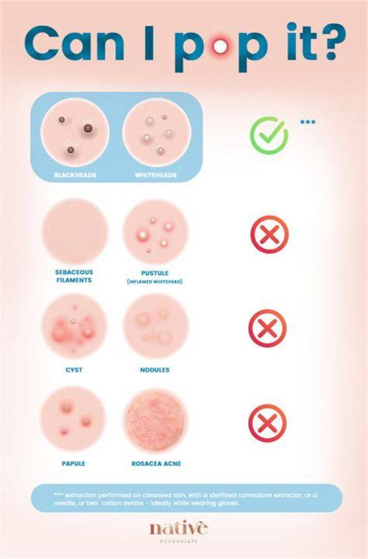 Can you pop an infected pimple?