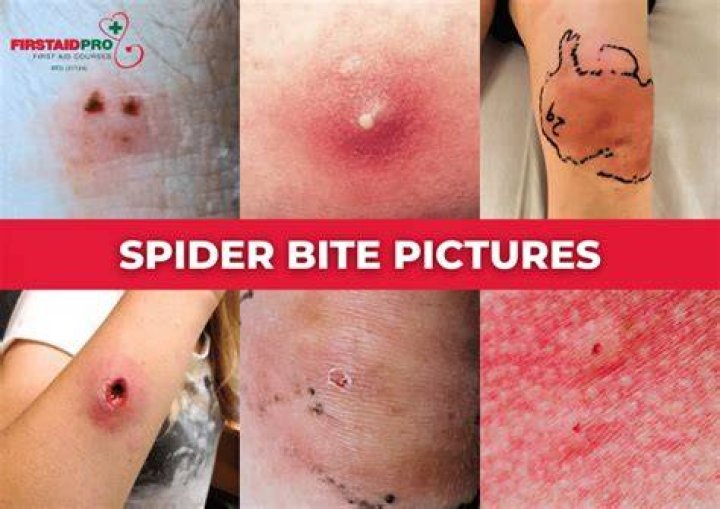 Do spiders bite at night?