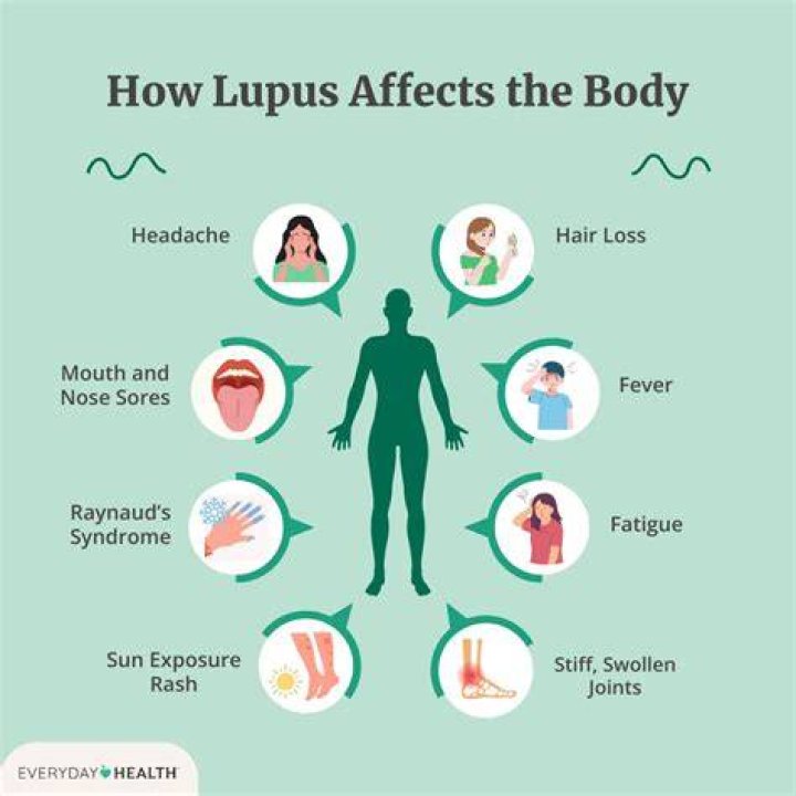 Does lupus affect the legs?