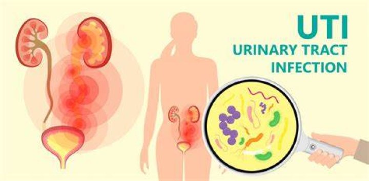 How do you make a urine infection go away fast?