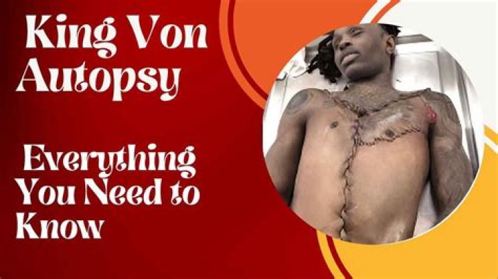 King Von Autopsy Results: Cause Of Death Revealed