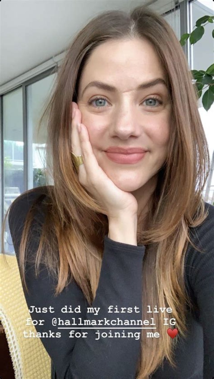 Ultimate Guide To Julie Gonzalo's Scar: History, Causes, And Significance