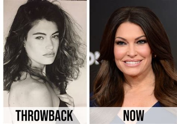 Uncovering Kimberly Guilfoyle's Face Surgery Transformation