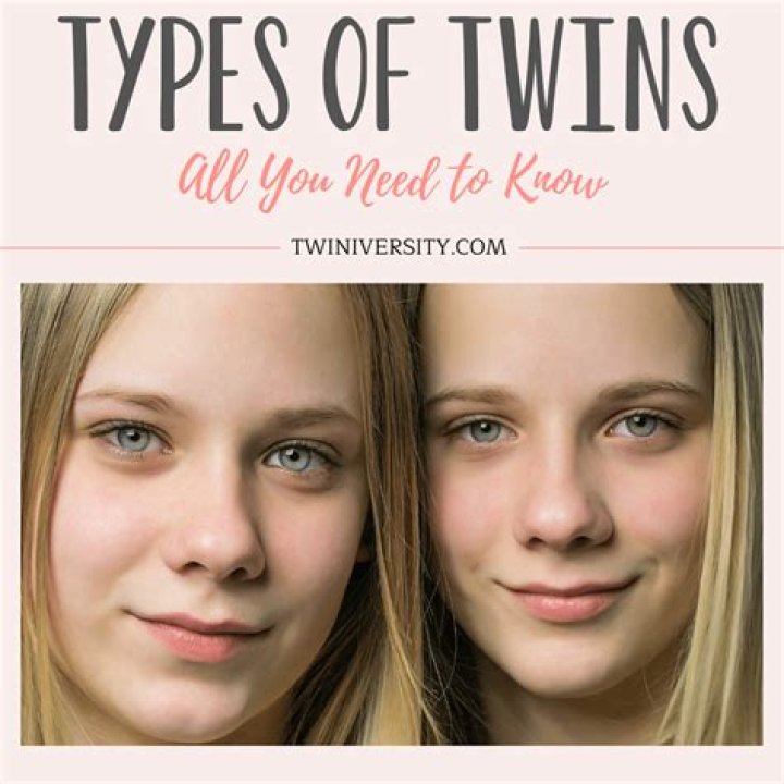 What are the 7 different types of twins?