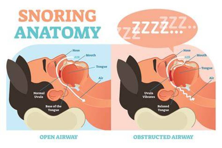 What causes snoring when sleeping on your side?