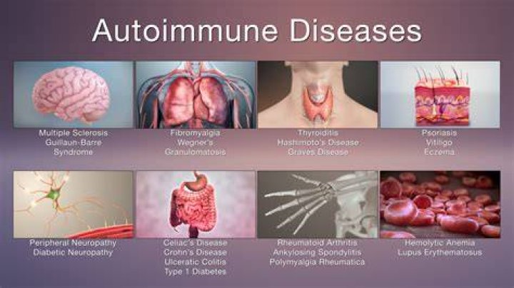 What diseases are considered autoimmune?