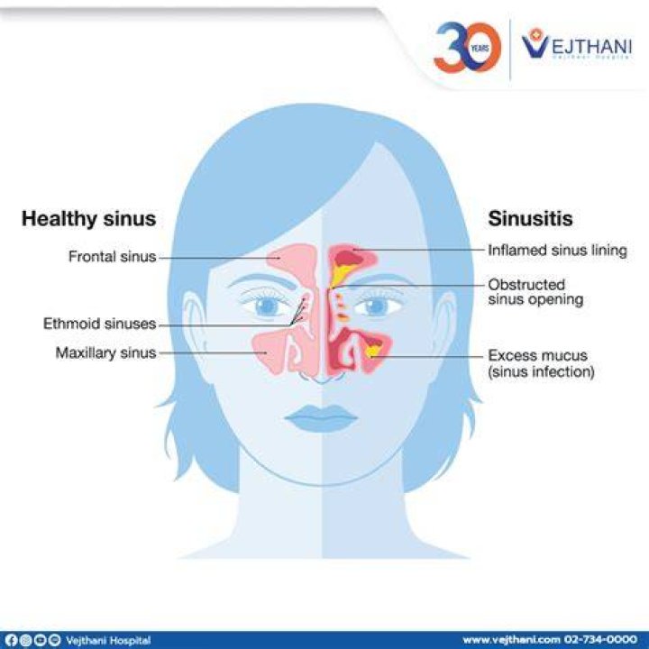 What happens if chronic sinusitis goes untreated?