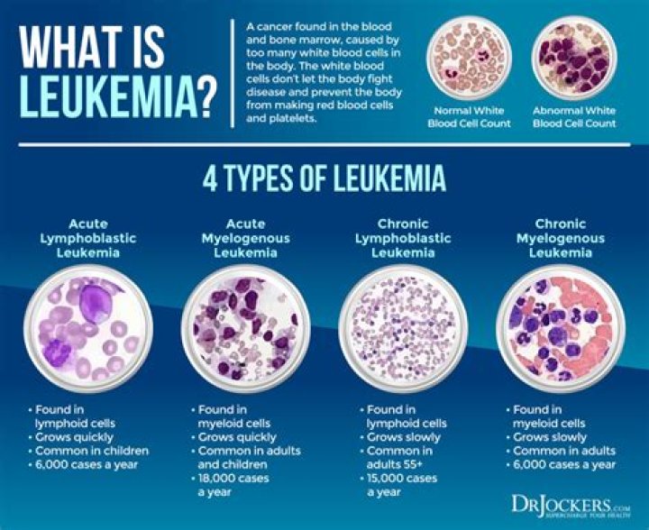 Why do people get leukemia?