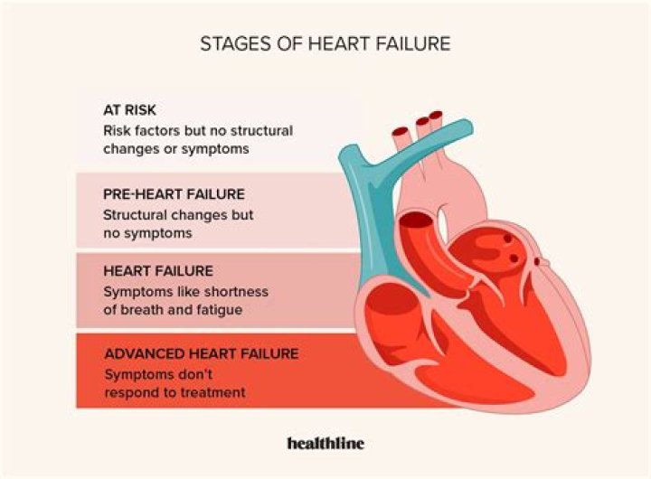 Why does sleep apnea lead to heart failure?